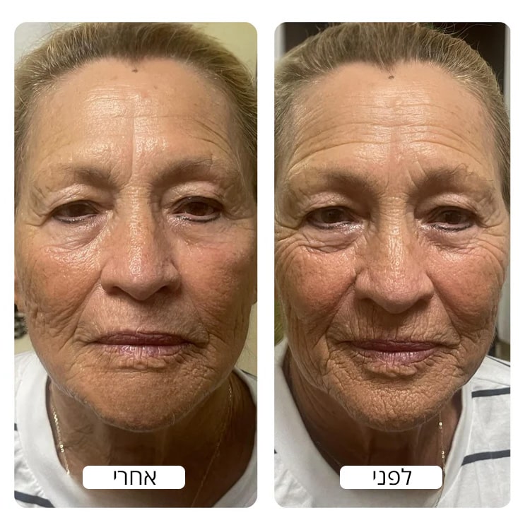 Aging_before_and_after_photo_by_spacetouch_750x_crop_center-min