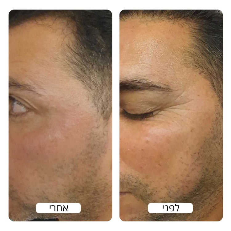 Before_and_After_By_Spacetouch_750x_crop_center-min